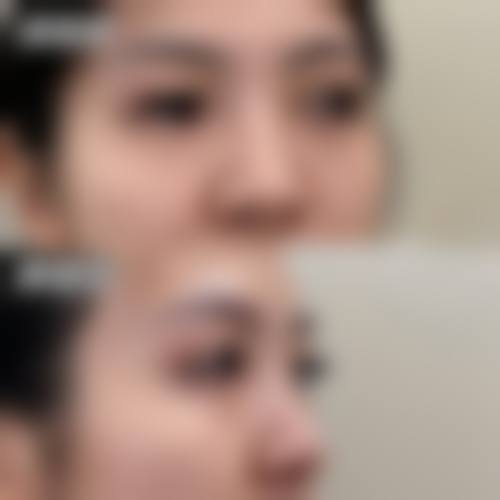 八、广州天河妍希医疗美容门诊部预约方式