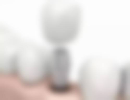 优惠活动详情:限时补贴,减轻负担