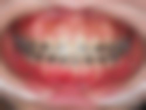 结尾总结与优惠留客