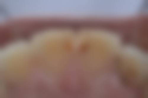 总结