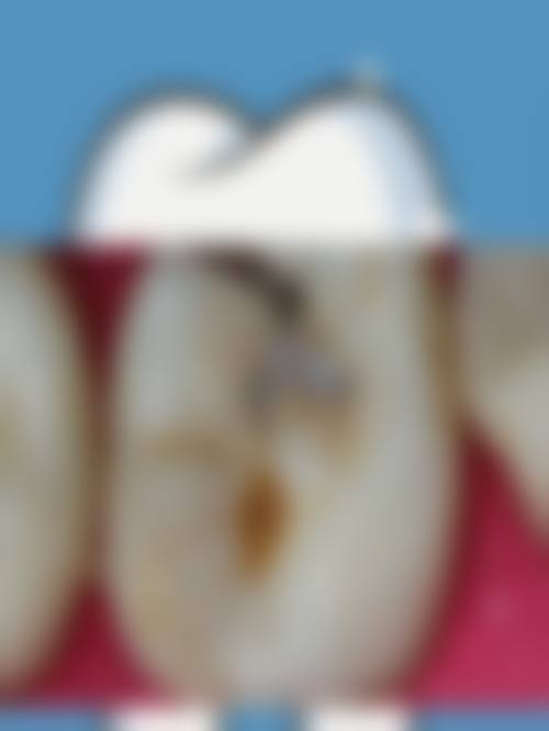 常见问题解答