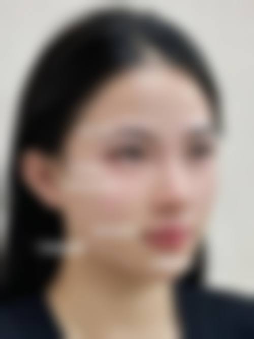 二、河南汇星医疗美容整形怎么样?