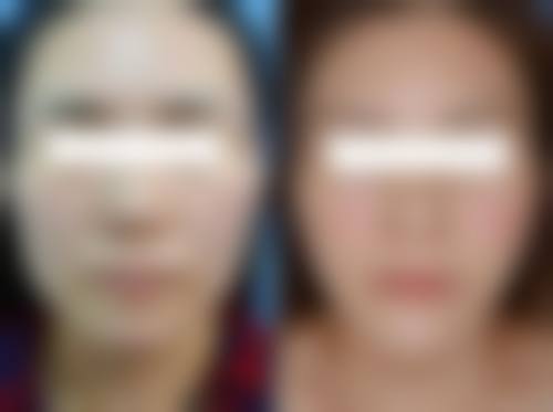 四、重庆沙坪坝唯尔美综合门诊部特色项目