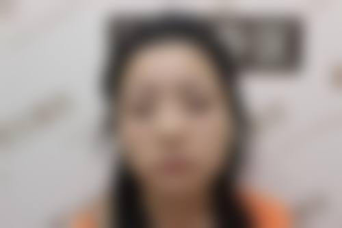 九、西安碧莲盛医疗美容诊所有限公司真实的患者评价