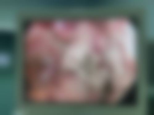 四、榆树陈伟激光整形美容机构特色项目