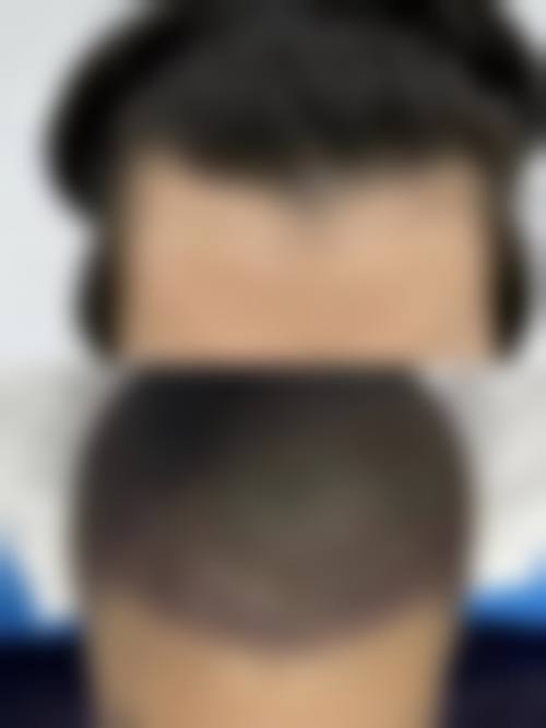 四、西安碧莲盛医疗美容诊所有限公司特色项目