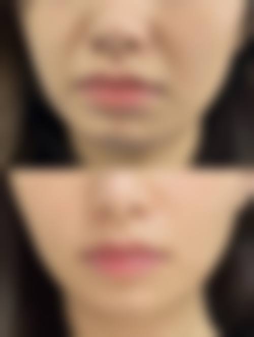 二、榆树陈伟激光整形美容机构怎么样?