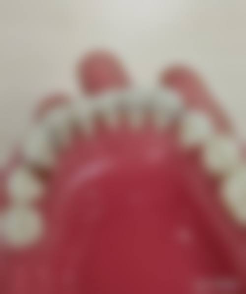 优惠活动详情：以更实惠的价格享受高品质口腔服务