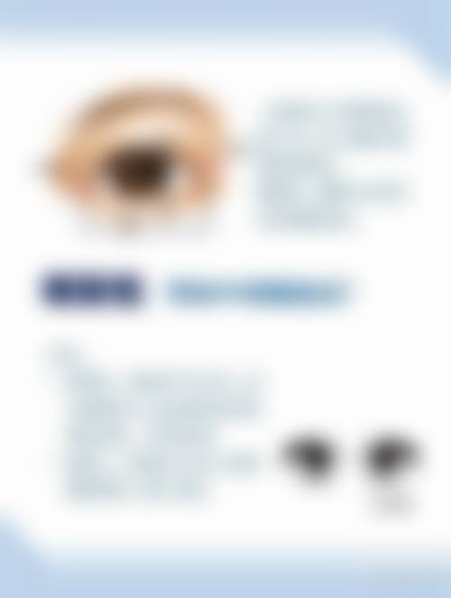 预约优惠活动 北华大学附属医院眼科魏来