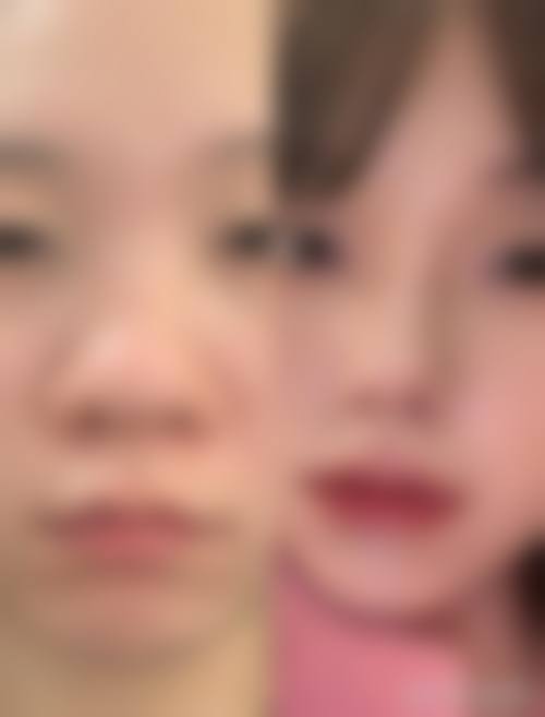 三、大连光普整形医院诊疗项目有哪些?