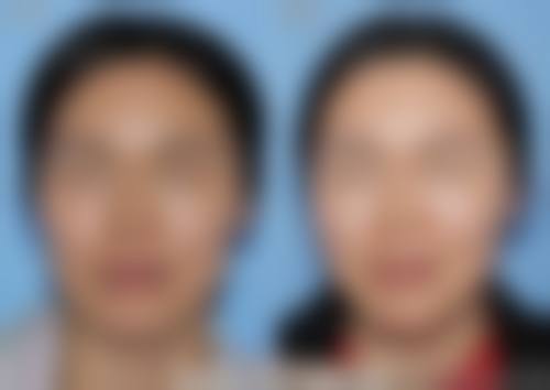 二、沈阳沈河兰玉整形医院怎么样?