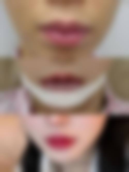 九、南京连天美医疗美容医院真实的患者评价