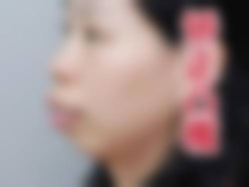 擅长项目详解