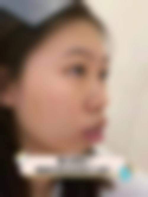 临床实例分享