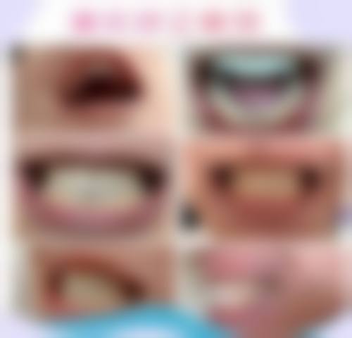 FAQ:常见问题解答
