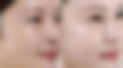 总结:选择山东潍坊昌邑邑城口腔,踏实放心