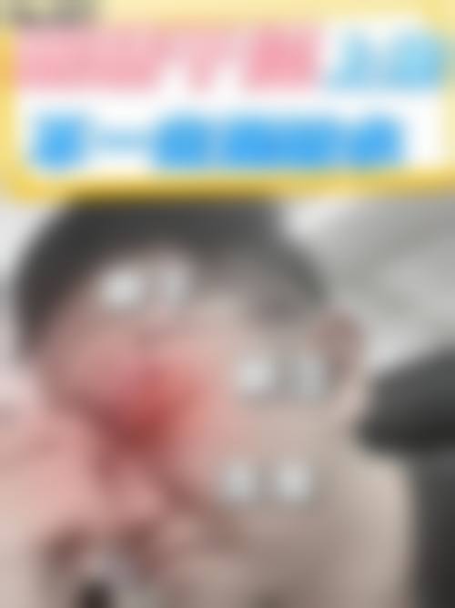 擅长项目详解