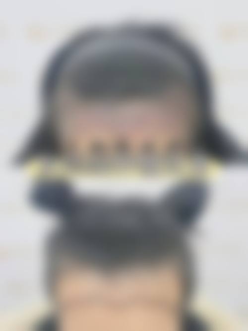 优惠活动详情:轻松预约,专属补贴