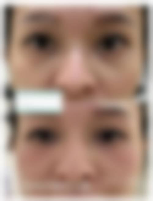 八、三亚晨熹医疗美容诊所真实的患者评价