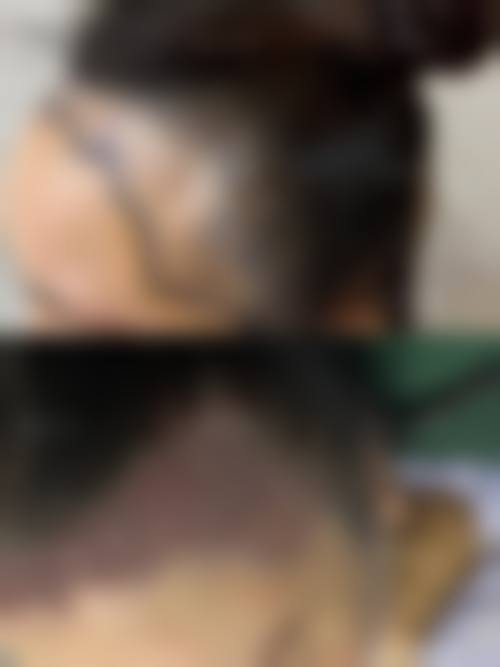 八、东莞维多利亚妇儿整形医院真实的患者评价