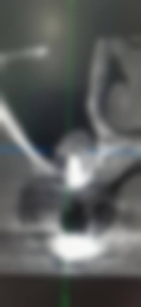Q:种植牙优惠活动如何参与?