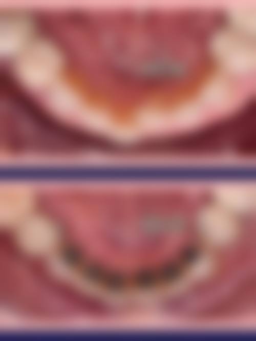 优惠活动详情:限时体验价与便捷预约方式