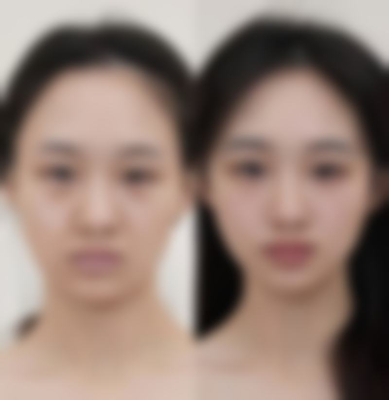 八、烫伤后的头皮还能种植头发吗:结尾总结
