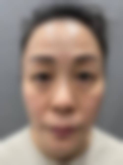 三、金俊永技术优势