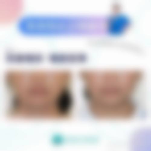 特色科室与项目——数字化诊疗精细效率高