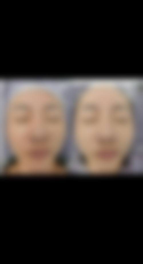 优惠活动详情