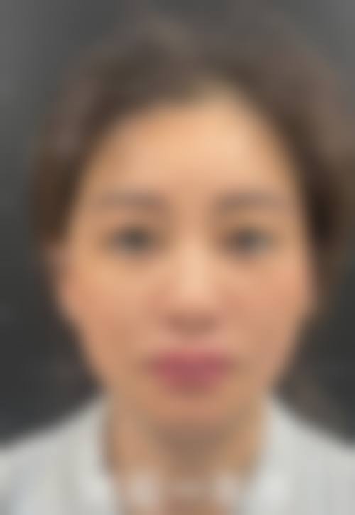 八、梅州皇佳贝丽整形医院真实的患者评价