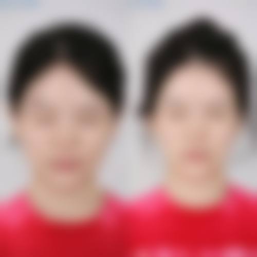 二、梅州皇佳贝丽整形医院怎么样？