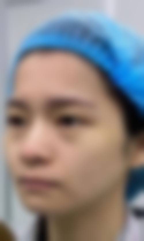 九、成都雅肤媛医疗美容门诊部真实的患者评价