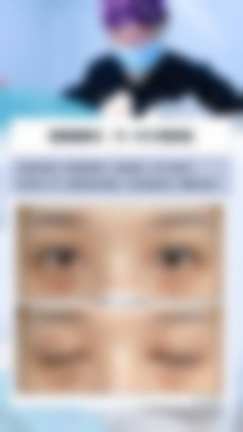 精良设备与环境:层流手术室与正版材料认证