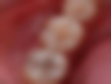 项目价格明细:透明定价与限时优惠