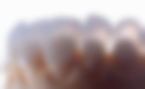 优惠活动详情:热门项目,实惠触手可及