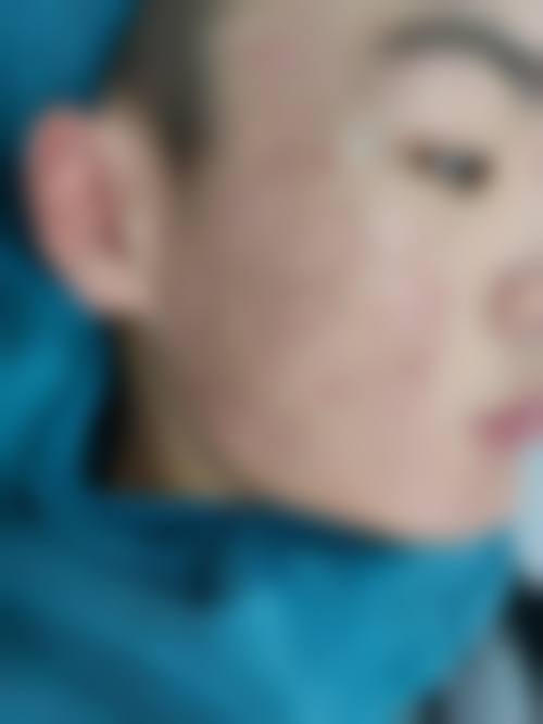 五、覃艳妮怎么预约?