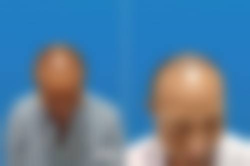 六、济南大麦科发源微针植发医院价格表