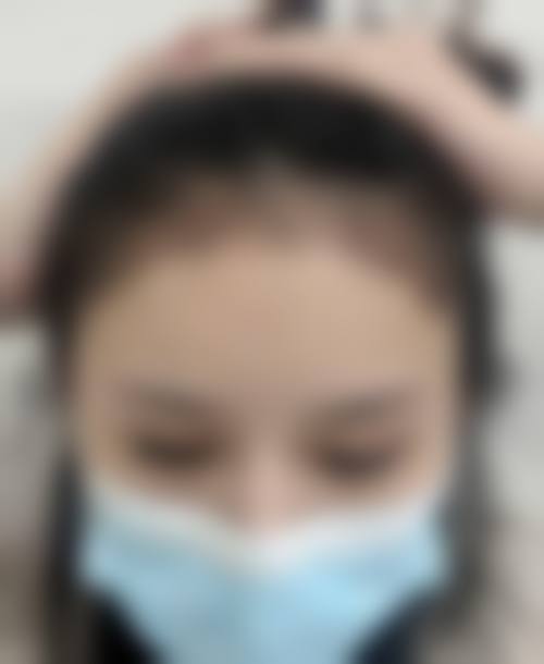 三、济南大麦科发源微针植发医院诊疗项目有哪些?