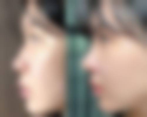 四、覃艳妮收费价格表