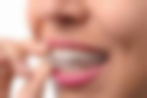 总结:选择临湘爱牙口腔,开启自信笑容