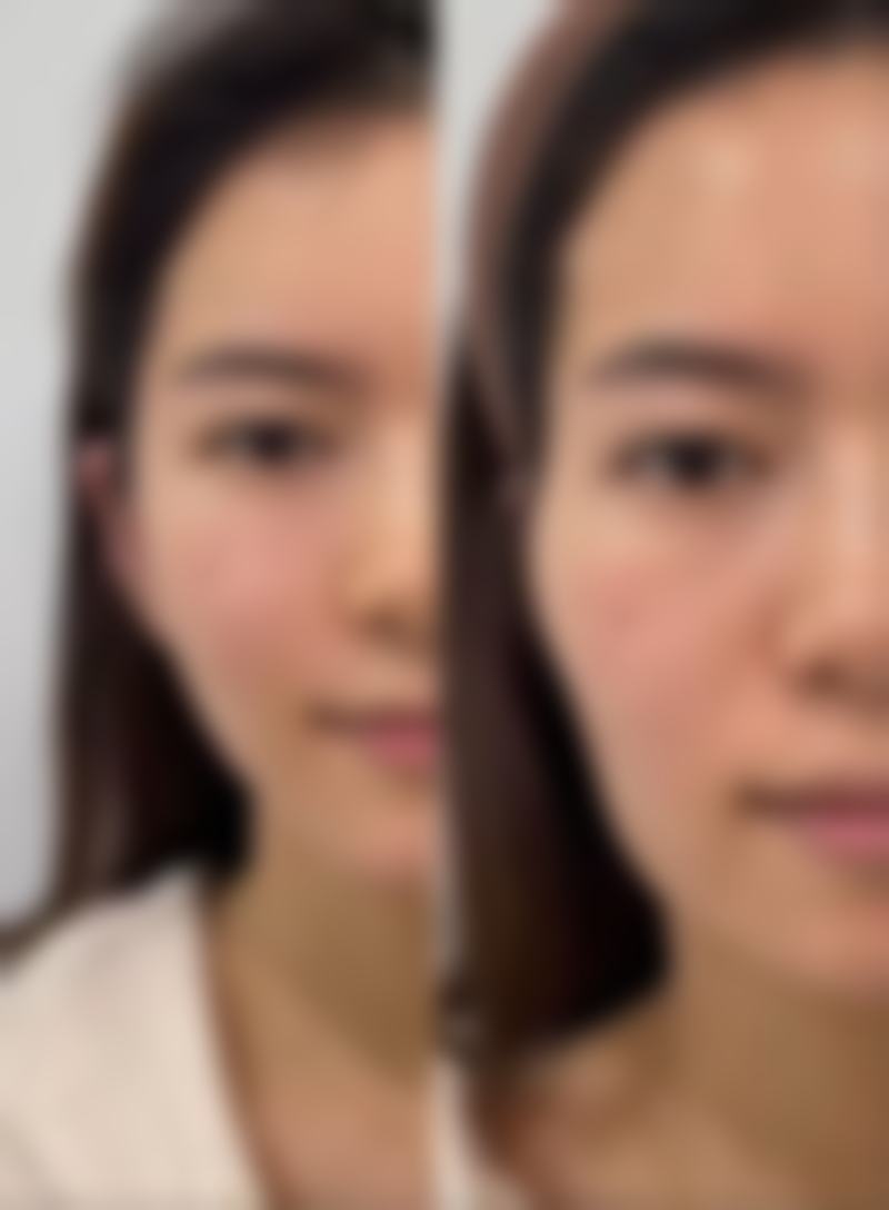 四、江门澳美医疗美容门诊部特色项目