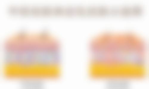 二、按摩去眼袋的常用穴位及功效