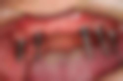 热门优惠活动详情:原价与优惠价对比