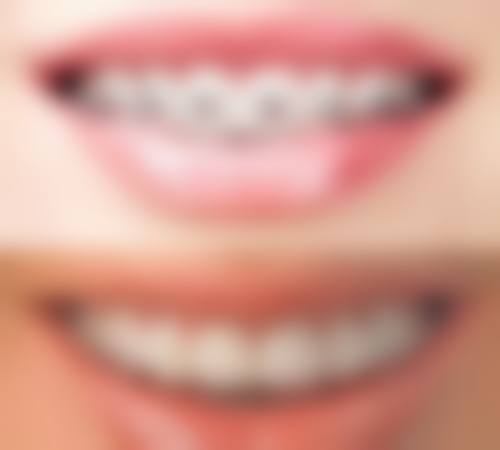 结语:选择专精,守护口腔健康