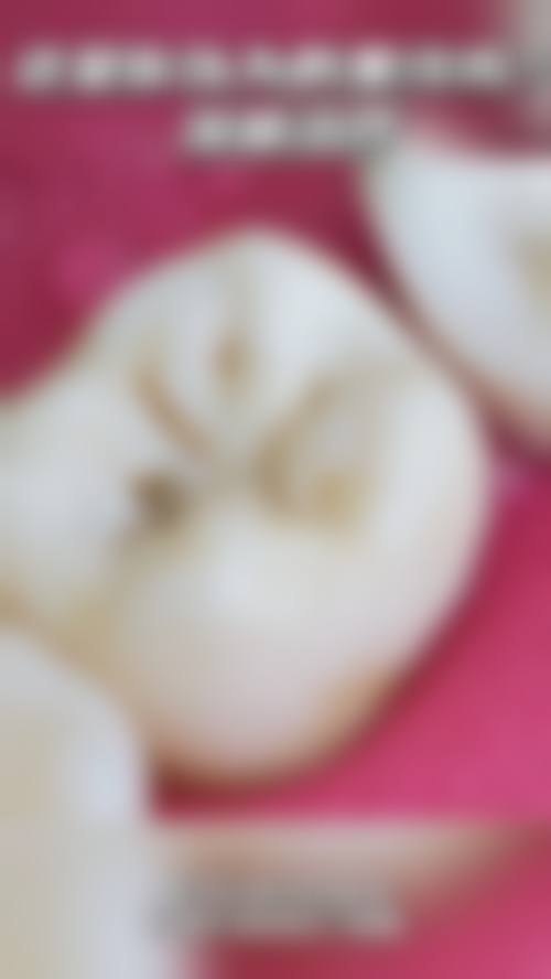 临床实例分享