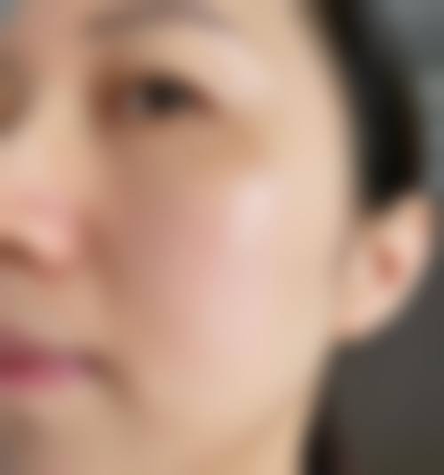 四、昆明薇诺娜整形美容门诊部特色项目