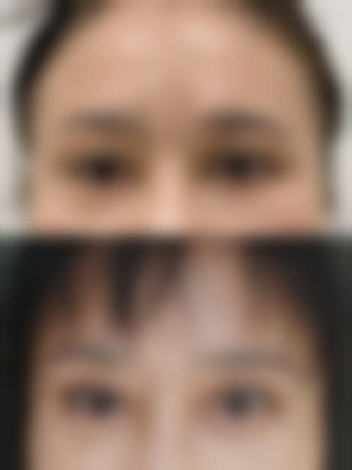 八、河南省立眼科医院(眼整形眼眶病泪道病中 心)预约方式