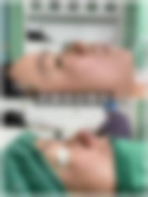 二、河南省立眼科医院(眼整形眼眶病泪道病中 心)怎么样？
