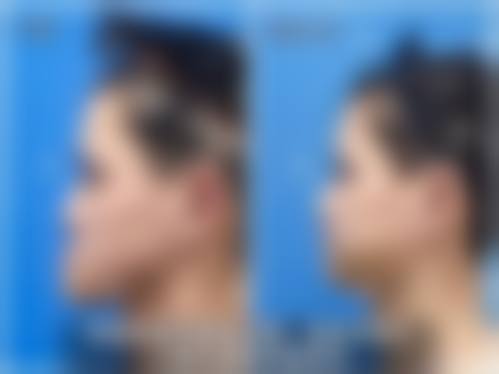八、武汉若然医疗美容医院真实的患者评价